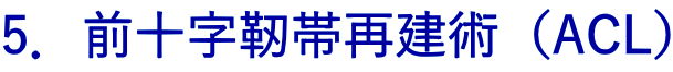 5．前十字靭帯再建術（ACL）